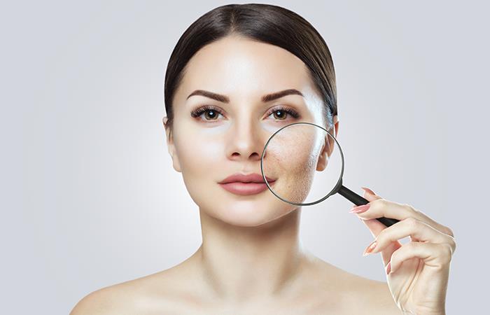 Cómo eliminar las arrugas sin pasar por quirófano