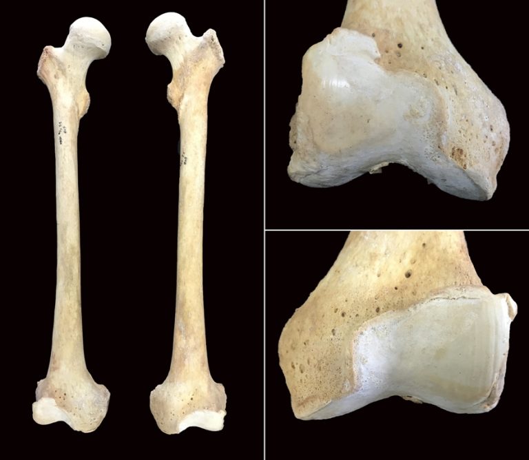 Investigadores refuerzan los modelos estadísticos para analizar enfermedades del pasado