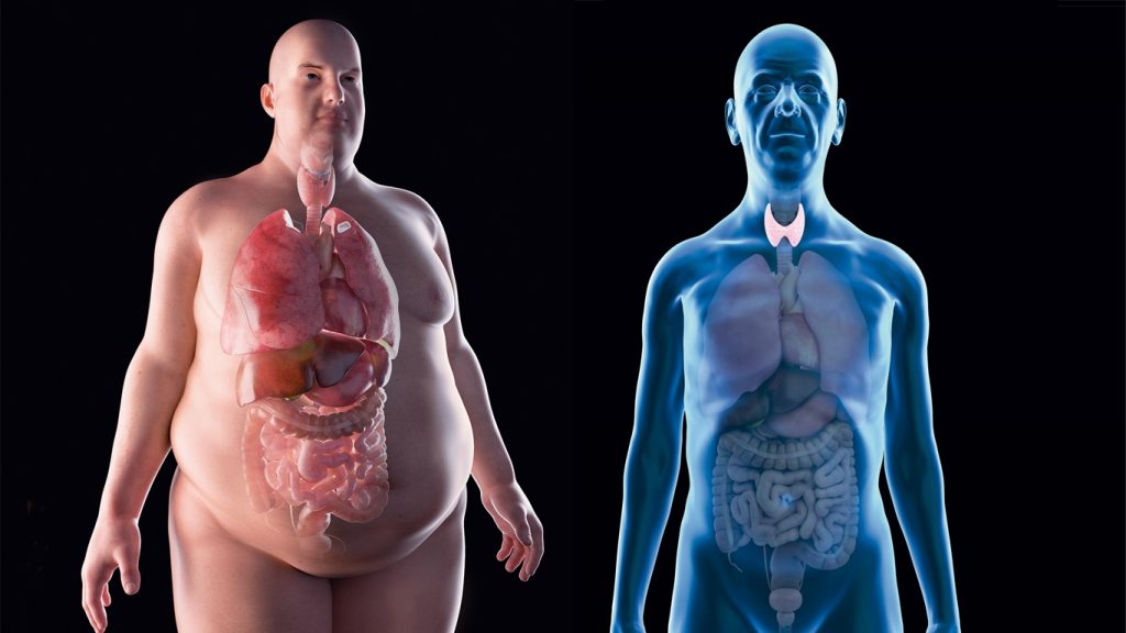 Hipotiroidismo señales que te avisan de que lo sufres