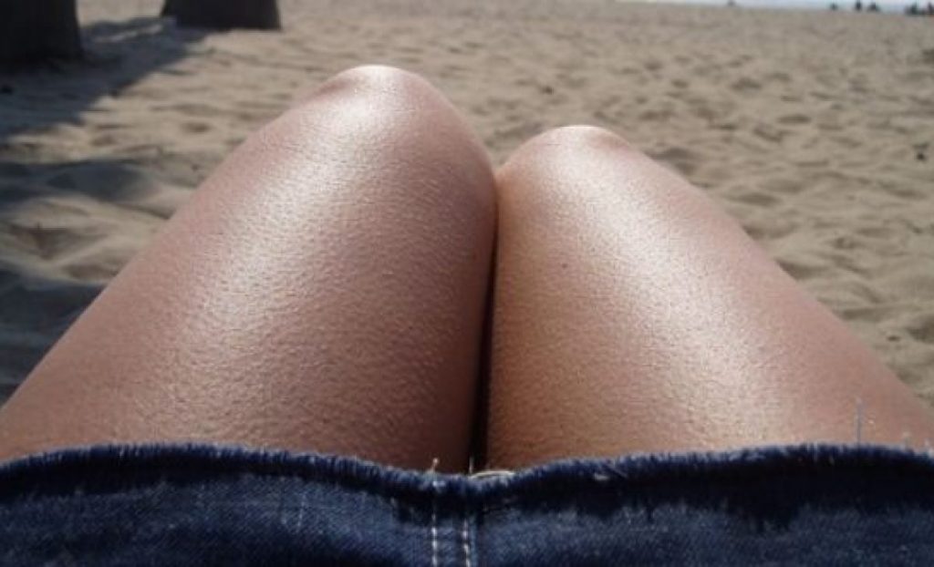 La llegada de la piloerección cuerpo