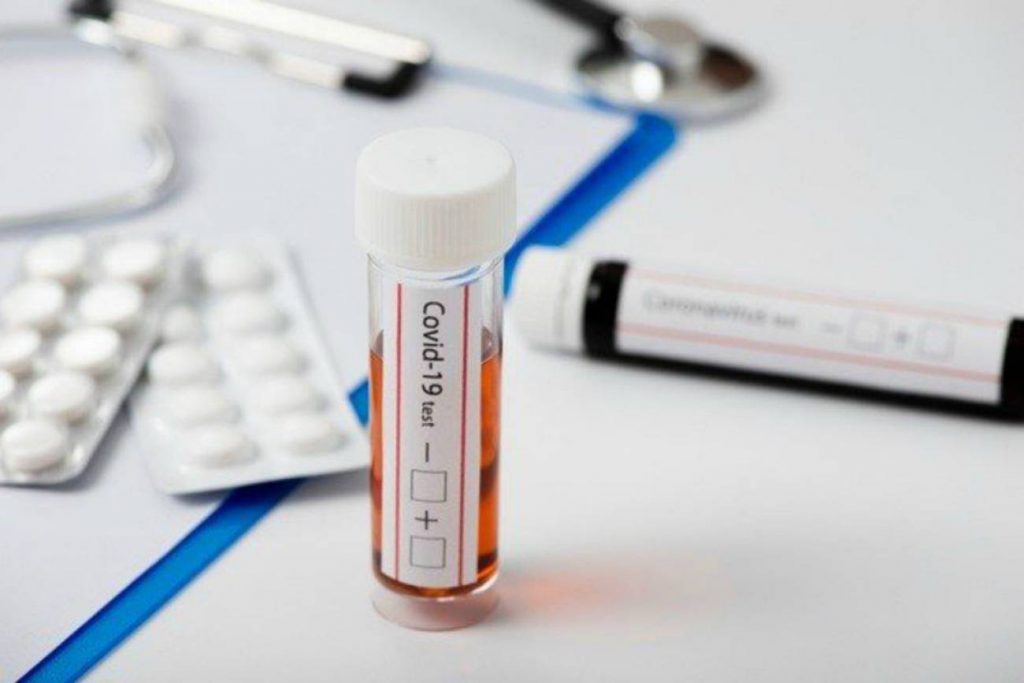 Así es el test rápido de antígenos covid para casa y con el móvil