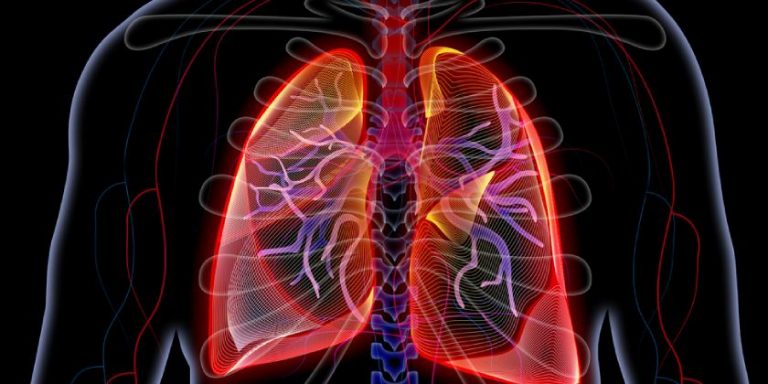 La mortalidad por el Covid-19 en los pacientes con trasplante pulmonar fue del 40%