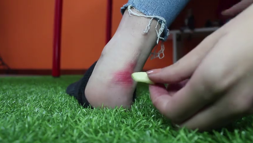 ¿Cómo tratar una ampolla?