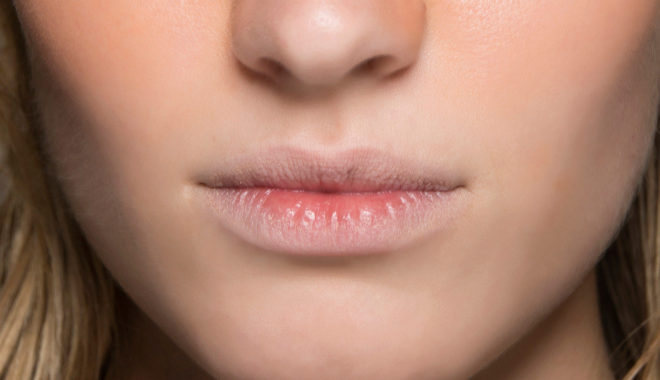 Causas de de los labios agrietados