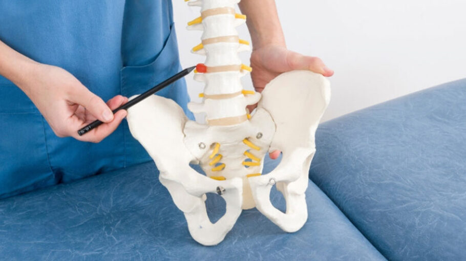 Qué es la hernia discal 153 Causas de la hernia discal
