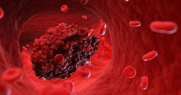 Qué es un trombo 49 Función de los coágulos