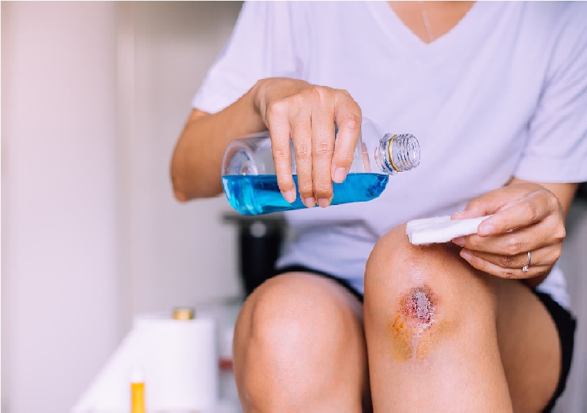 Limpiar y desinfectar la herida