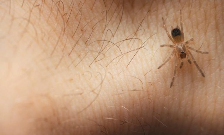 Cómo tratar la picadura de araña
