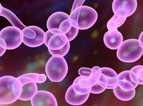 Qué es candidiasis Qué es candidiasis