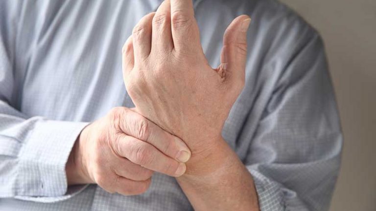 Qué es el síndrome del túnel carpiano