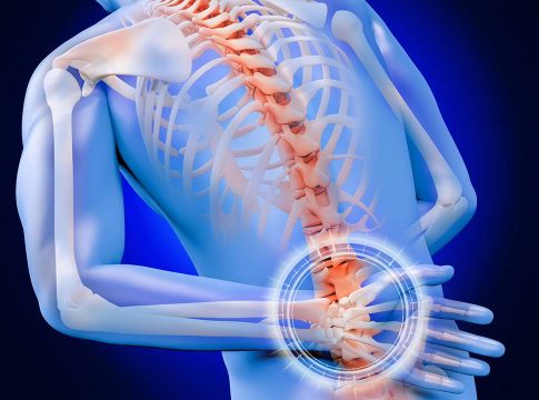 Qué es la hernia discal Qué es la hernia discal