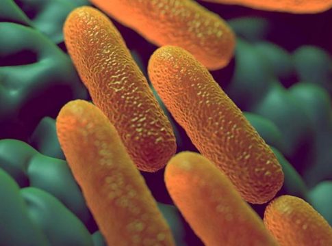 Qué es la salmonelosis Qué es la salmonelosis