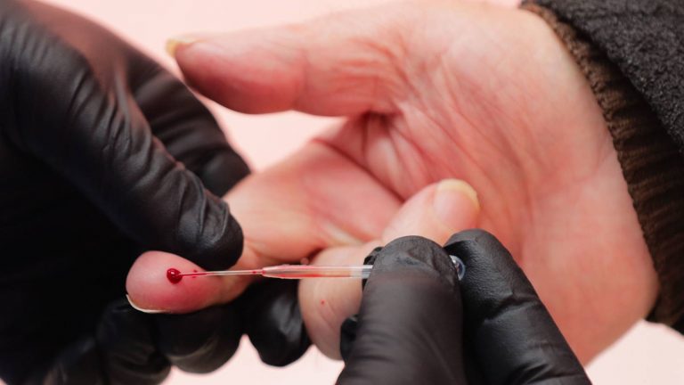 Qué es la serología