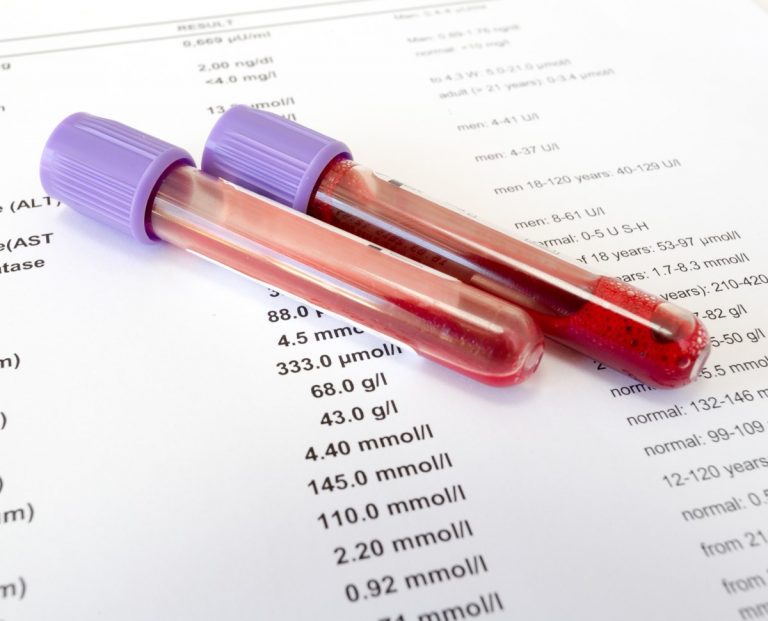 Qué es la trombocitopenia