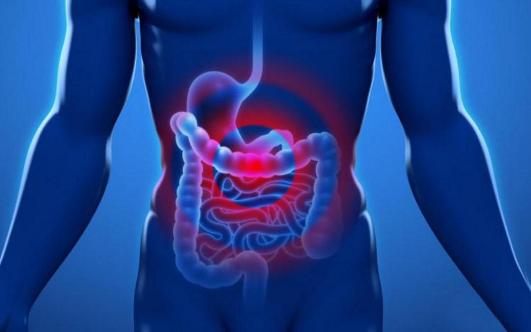 Qué es una peritonitis