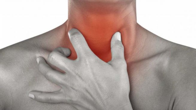 Qué es la faringitis 153 Tipos de faringitis