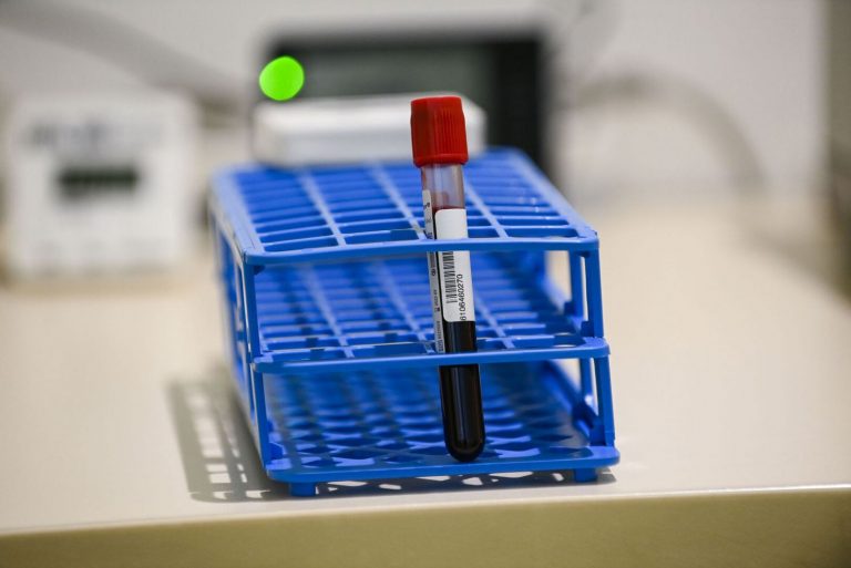 Covid: todo lo que se sabe de la variante de Uganda, ¿es más mortal? ¿Más contagiosa?