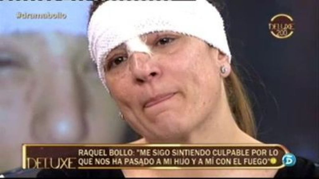 Sálvame: colaboradores que sufrieron accidentes domésticos