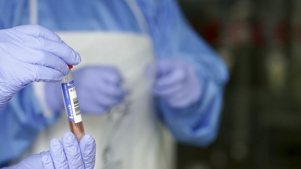 Una nueva variante del Covid ha llegado a España: la de Uganda.