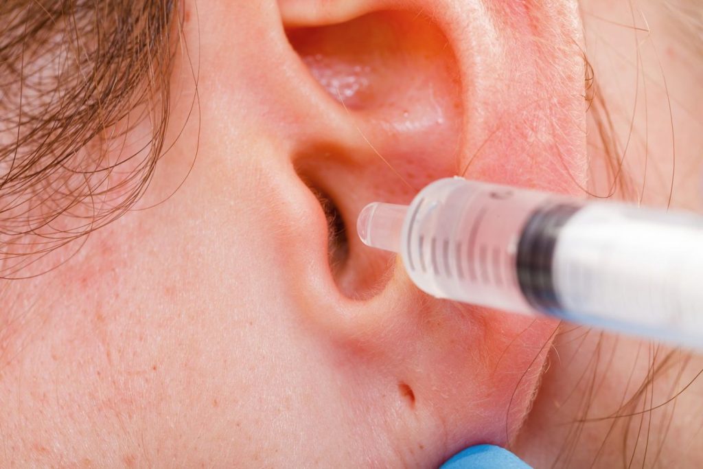 Cómo limpiar el cerumen de los oídos 3 ¿Y qué hacer cuándo hay un tapón de cerumen en los oídos?