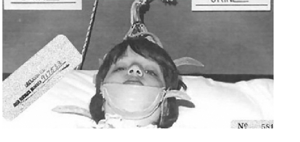 10 aterradores experimentos que se realizaron con humanos