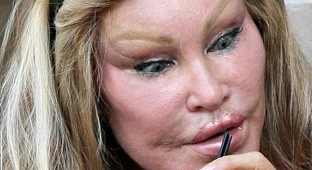 10 famosos DESTROZADOS por la cirugía estética