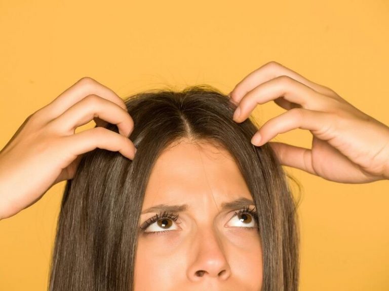 Causas y tratamiento para combatir el molesto cuero cabelludo graso