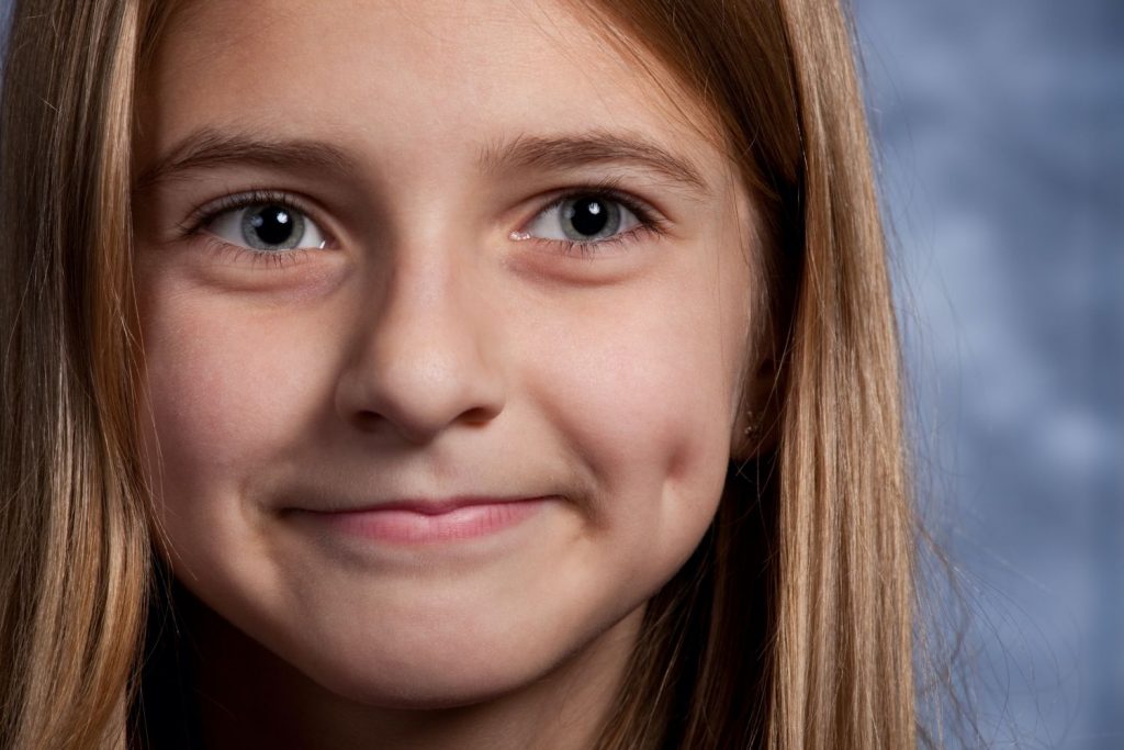 ¿Cuáles son los tipos de hoyuelos?