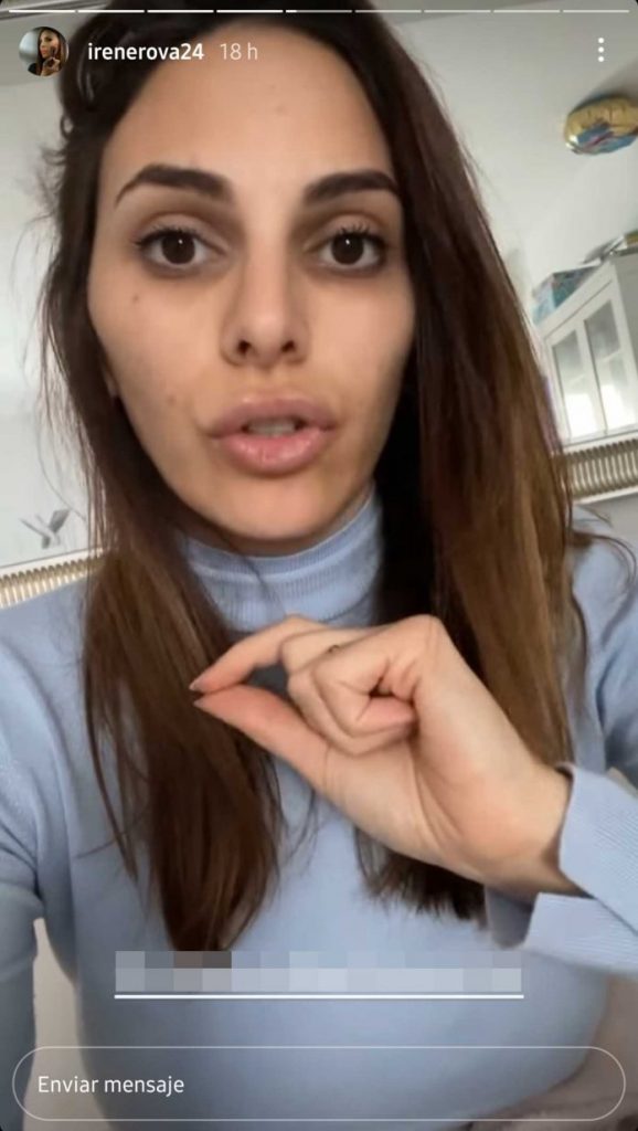 La llegada del bótox irene rosales