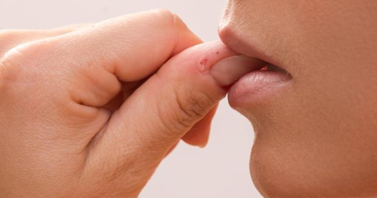 Qué es la dermatofagia