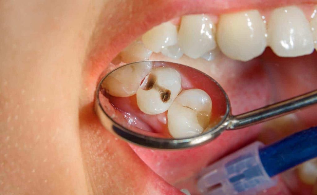 Te cuidas de las caries té blanco 