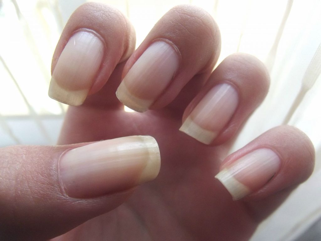 Cómo blanquear tus uñas 49 ¿Por qué las uñas se ponen amarillas?