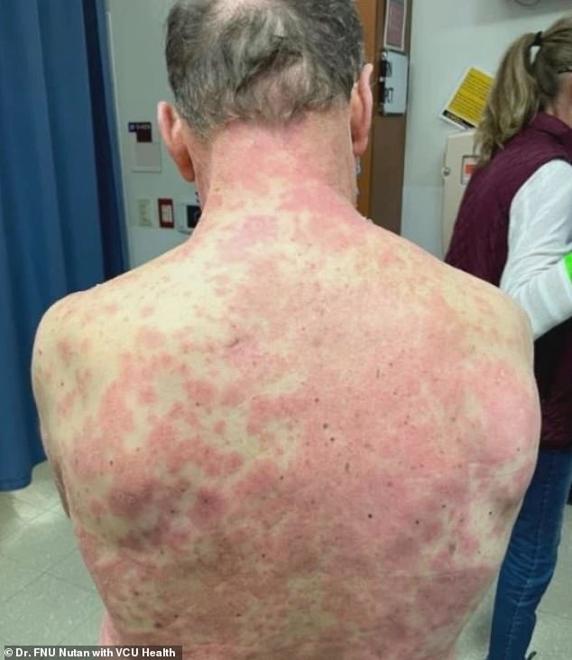 La terrorífica y extraña reacción secundaria a la vacuna de Janssen