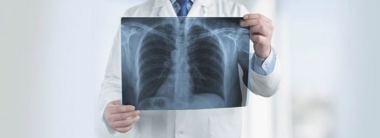 Desarrollan un método no invasivo para evaluar enfermedades pulmonares