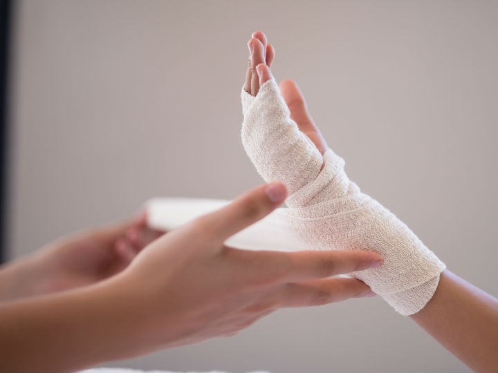 ¿Cuáles son los tratamientos para las quemaduras?