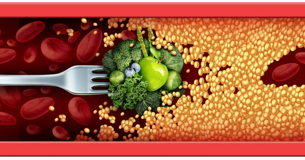 ¿Cuáles es la solución para el colesterol alto?