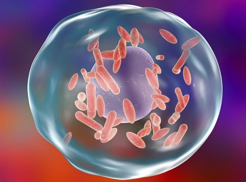 Qué es la fiebre Q Qué es la fiebre Q