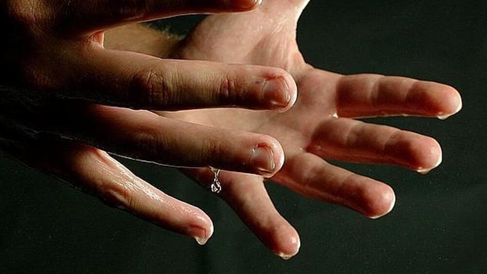 Qué es la hiperhidrosis