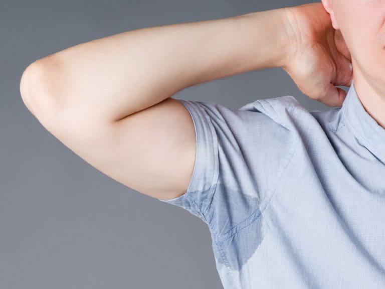 Qué es la hiperhidrosis