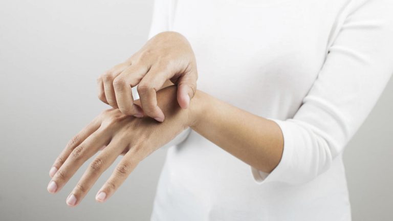 Según tu tipo de sangre, esta es la probabilidad de que los mosquitos te piquen este verano