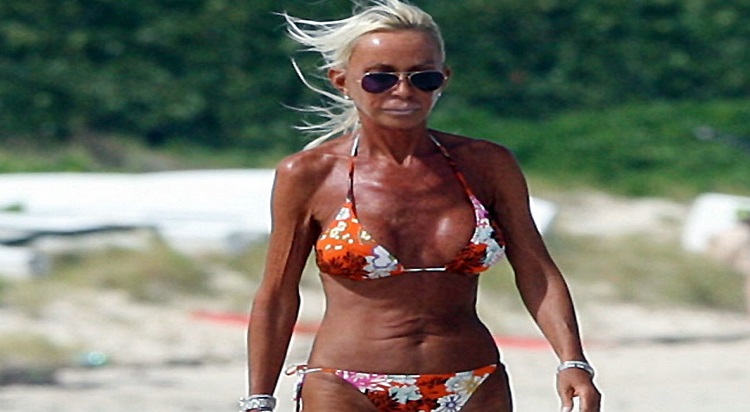 Los 10 peores pechos operados de las famosas