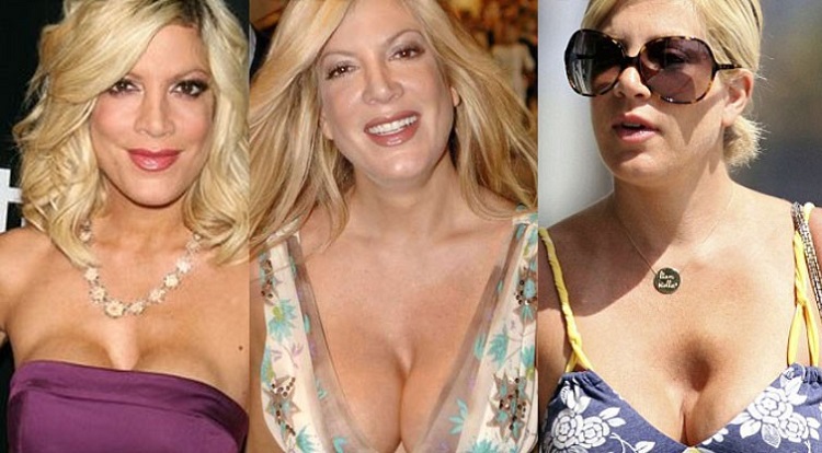 Los 10 peores pechos operados de las famosas 1 Los 10 peores pechos operados de las famosas