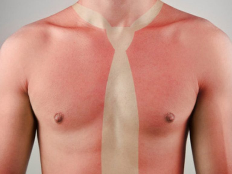 Cómo hacerte un tatuaje solar