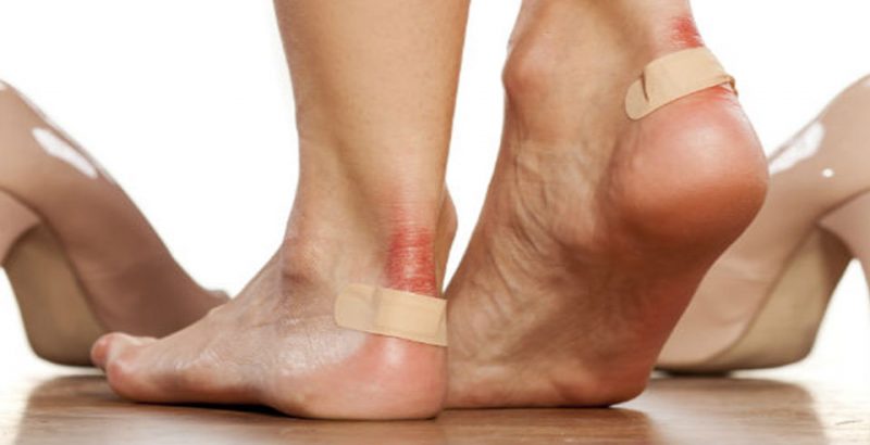 Cómo tratar las rozaduras en los pies 1 Top de cuidados para evitar rozaduras