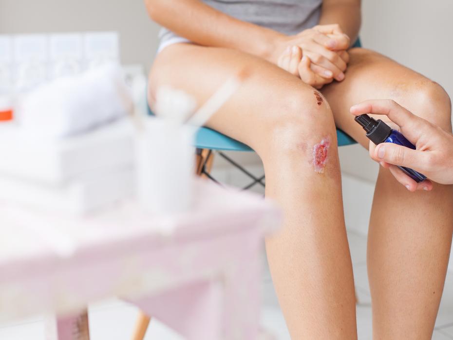 Tipo de herida y su correcta atención