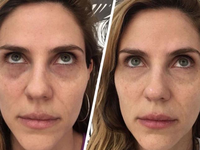 Trucos para combatir el problema