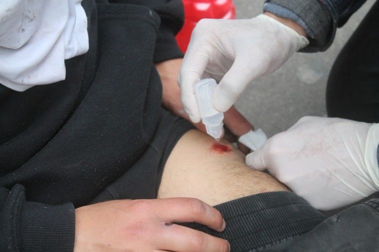 Cómo desinfectar cortes y heridas 3 Paso a paso para limpieza de cortes y heridas