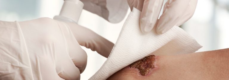 Cómo curar una herida en la ingle