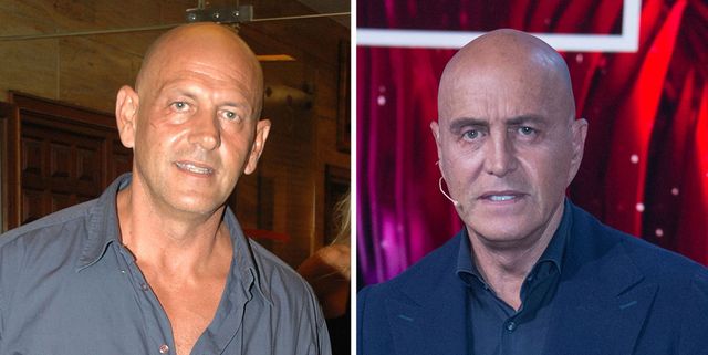 Kiko Matamoros: la millonada que se ha gastado en retoques estéticos