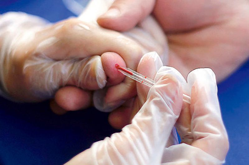 Qué es la mucormicosis